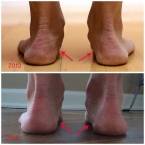 Minimalist ayakkabı değişiklik ayakları çalıştırmak için nasıl